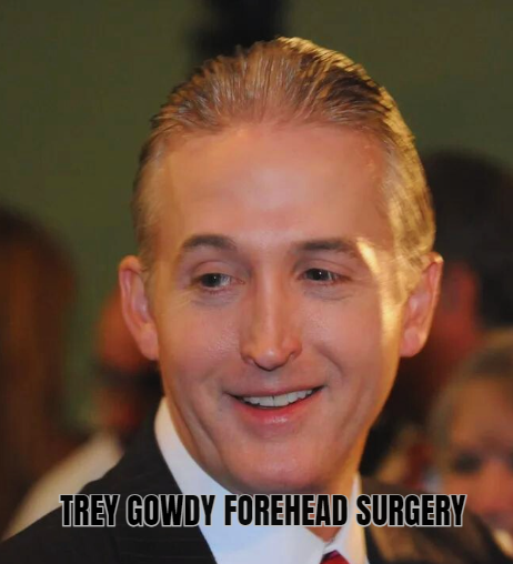 Trey Gowdy Forehead Surgery